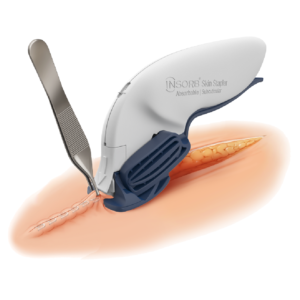 INSORB - Image 2