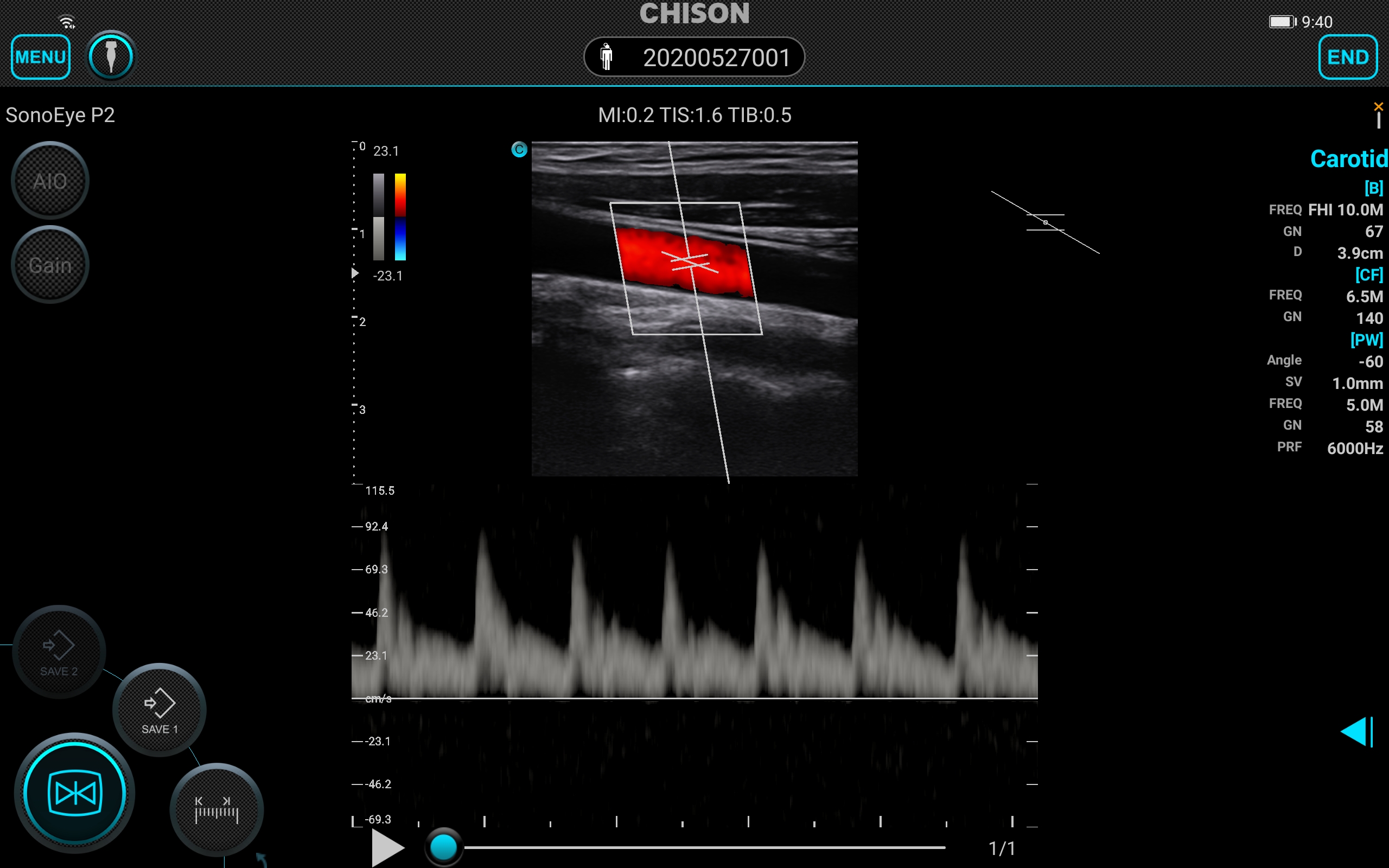 Ecógrafo SonoEye - Image 3